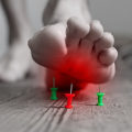 What is the first-line of treatment for neuropathy?