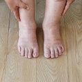 What is pre diabetic neuropathy?