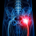 How long does it take nerves to heal?