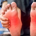 How do you know what stage of neuropathy you're in?