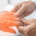 What is considered early onset peripheral neuropathy?