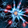 What is diabetic neuropathy in the chest?