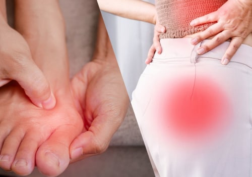 Can bunions cause neuropathy?