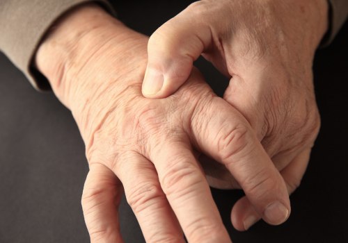 Can you live with neuropathy?