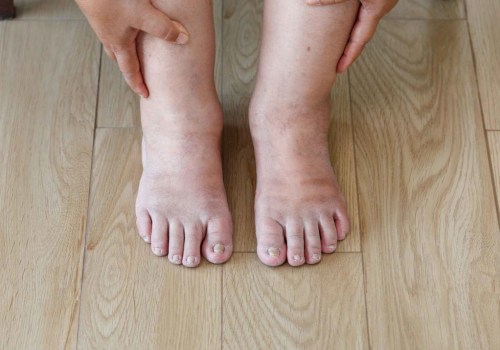 What is the earliest manifestation of diabetic neuropathy?
