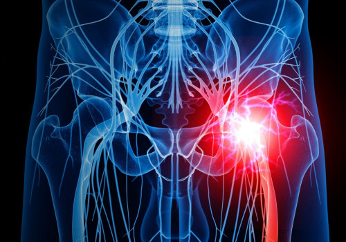 How long does it take nerves to heal?