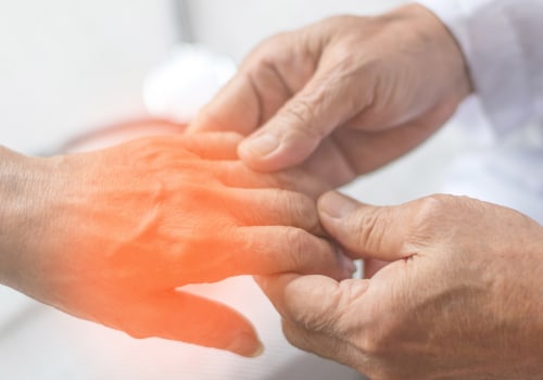 What are signs of severe neuropathy?