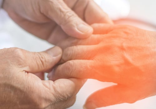 What is considered early onset peripheral neuropathy?