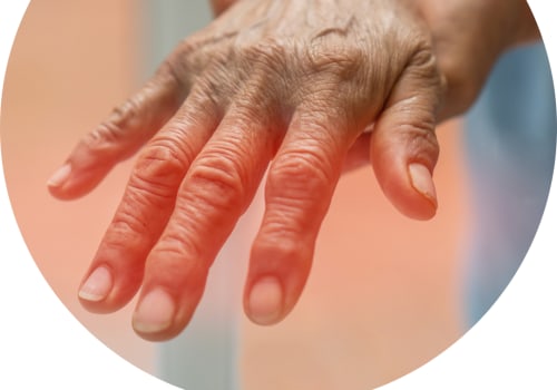 Can diabetes nerve damage be repaired?