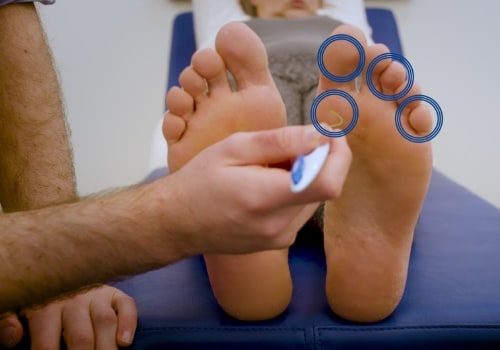 What is the special test for diabetic neuropathy?